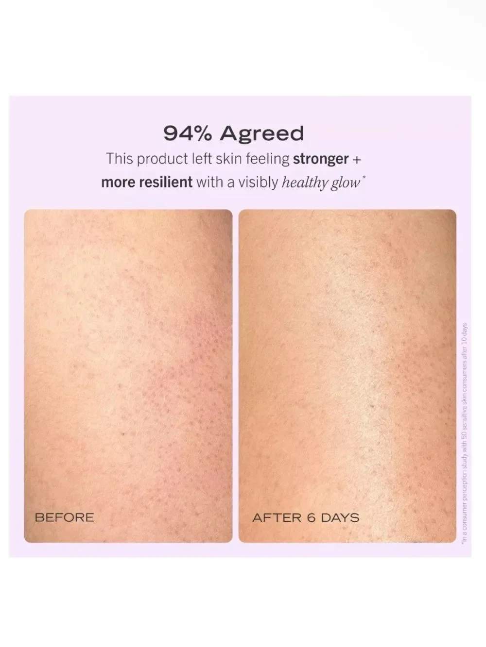 First Aid Beauty after nourishing shower
